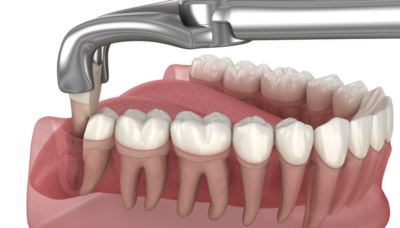 trattamenti generali
